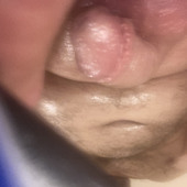 cummyshitlicker