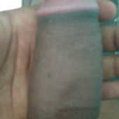 Pratheesh