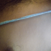 Aros