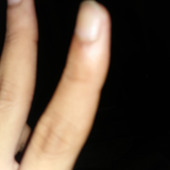Aakim