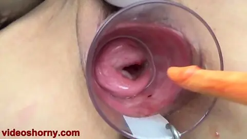 Asian Cervix Tearing Up With Lollipop Fuck Stick And Japanese Chopsticks